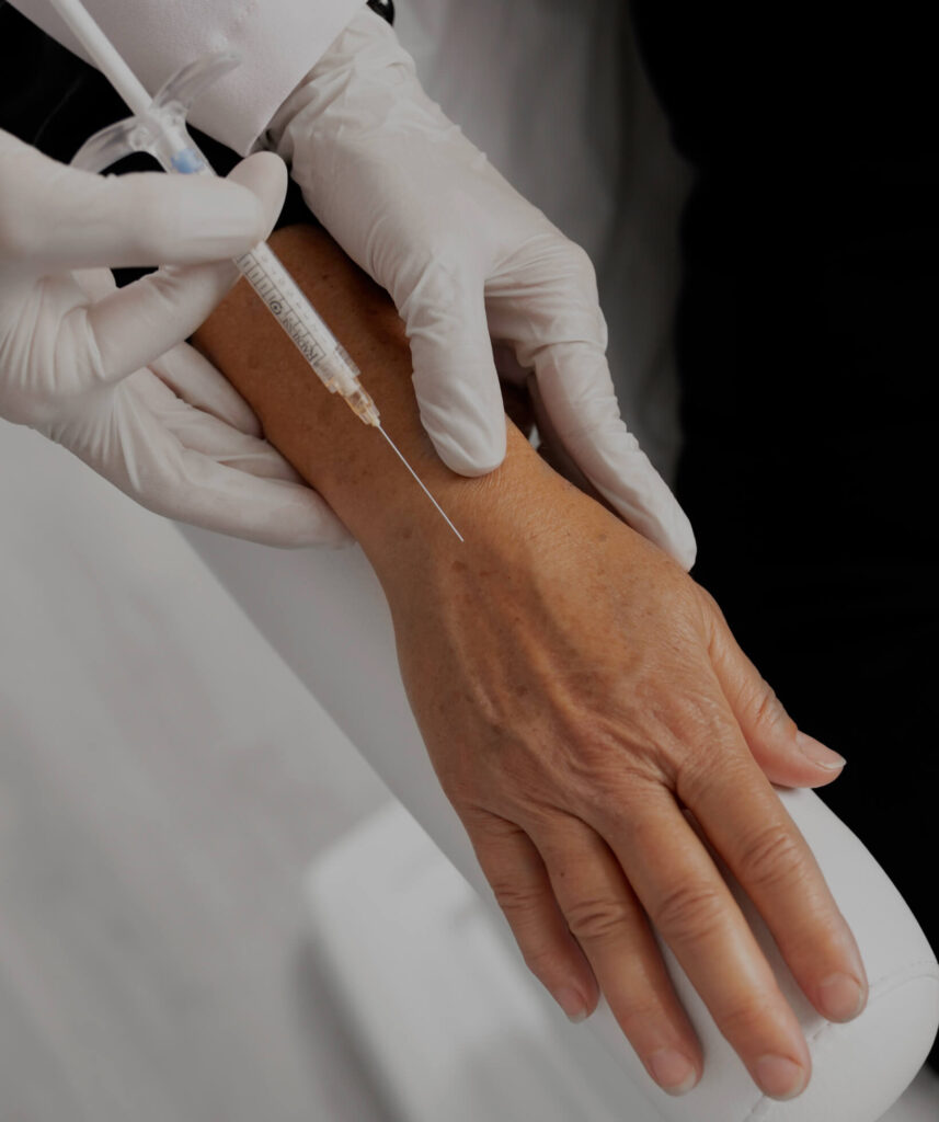 Hand Rejuvenation from Medical Aesthetics BY Lacey