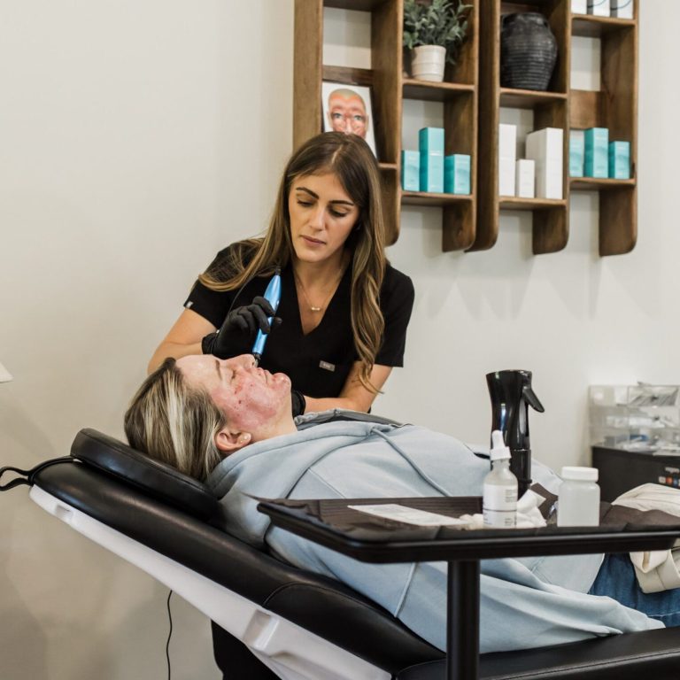 Micro Needling Med Spa Honeoye Falls